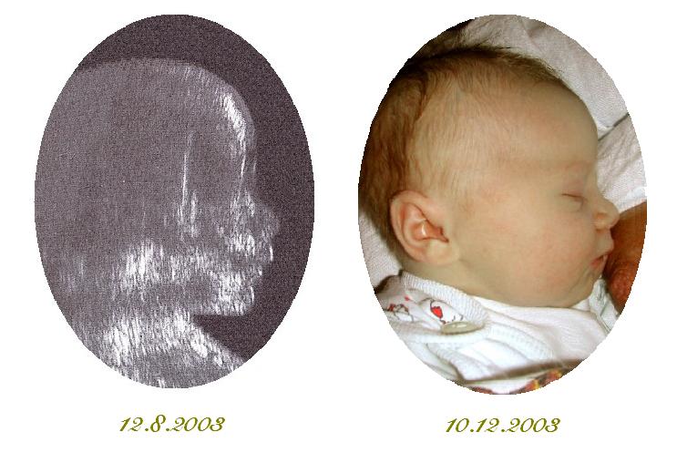 UZ1.jpg (57238 bytes)